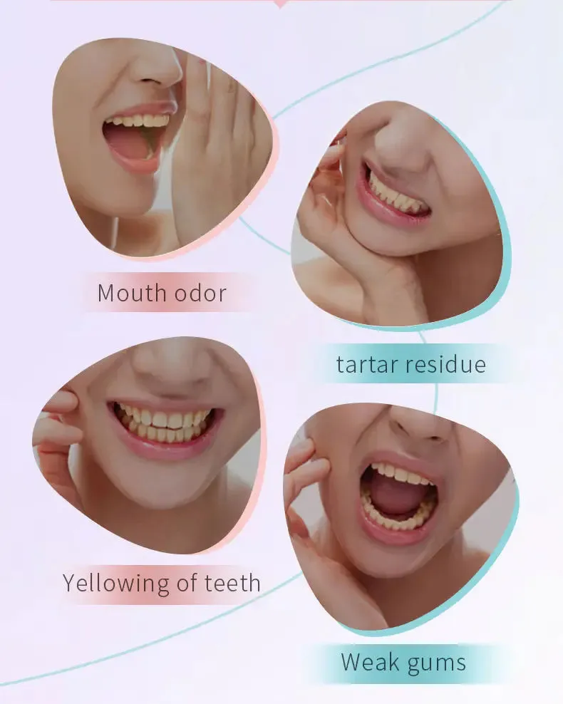 Niacinamide Whitening Toothpaste ( BUY 1 GET 1 FREE )